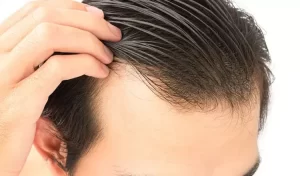 Can-homeopathy-help-your-hair-grow-back-after-thinning