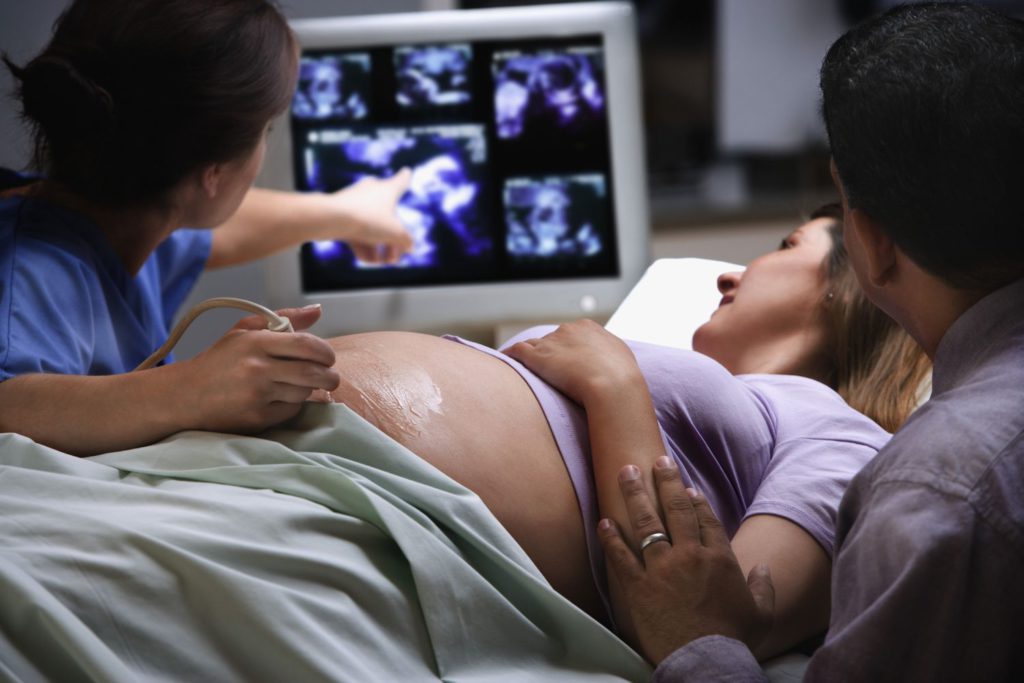 obstetrical ultrasound in Marietta, GA