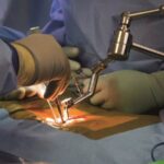 Dr. Larry Davidson Explores How AI Personalizes Spinal Implant Material Selection for Optimal