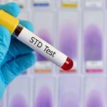 STD Testing
