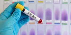 STD Testing