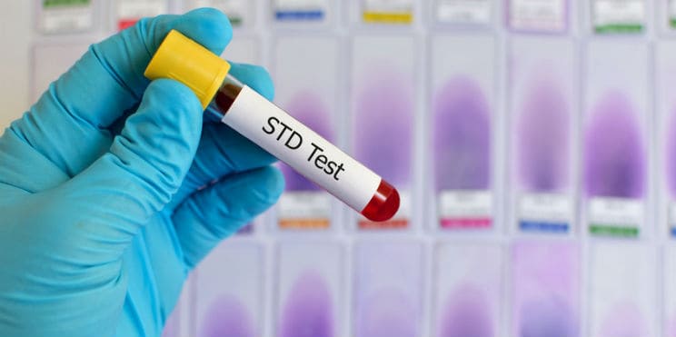 STD Testing